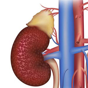 understanding-diabetic-kidney-disease-vijayawada