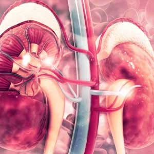 Chronic Kidney Failure in vijayawada