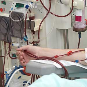Hemodialysis in vijayawada